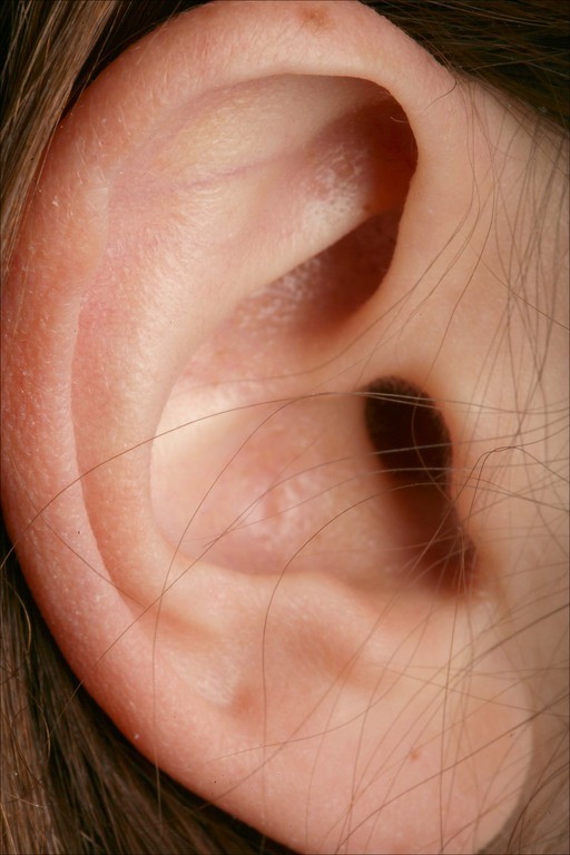 Ωτικά-Φροντίδα αυτιών-Ωτοασπίδες